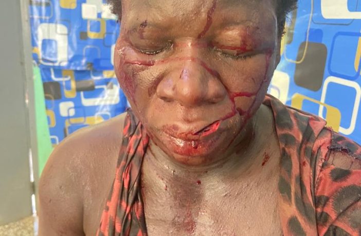 Oti Region: Husband inflicts cutlass wounds on pregnant wife.  Madam Mesuna Adiza, a seven-month-old pregnant woman is battling for her life as her husband has inflicted cutlass wounds on her at Banda in the Krachi Nchumuru District of the Oti Region.